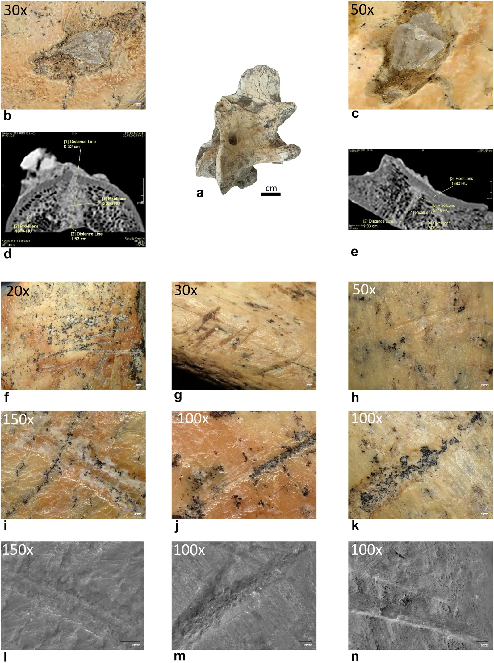 Vertebra