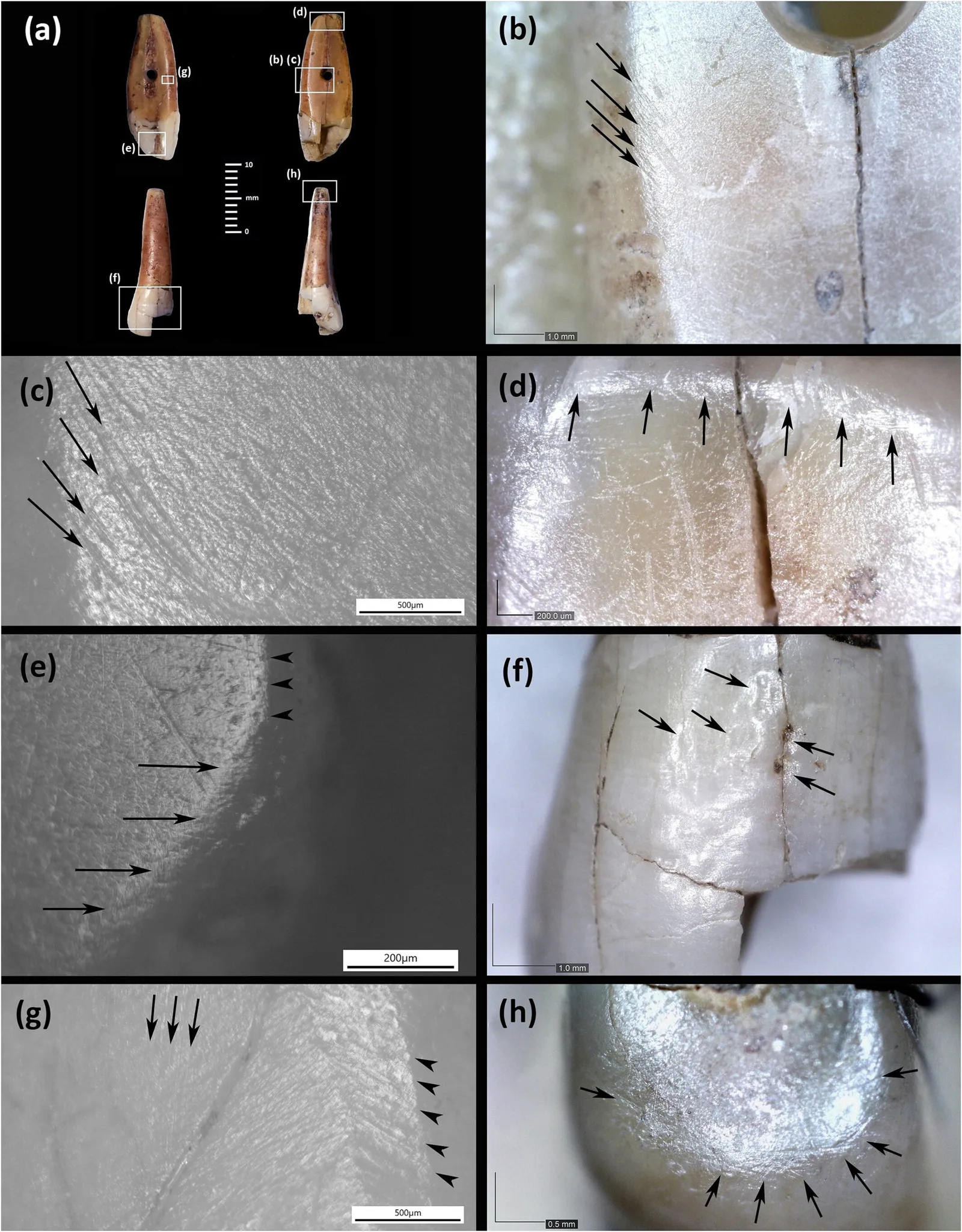 tooth 2