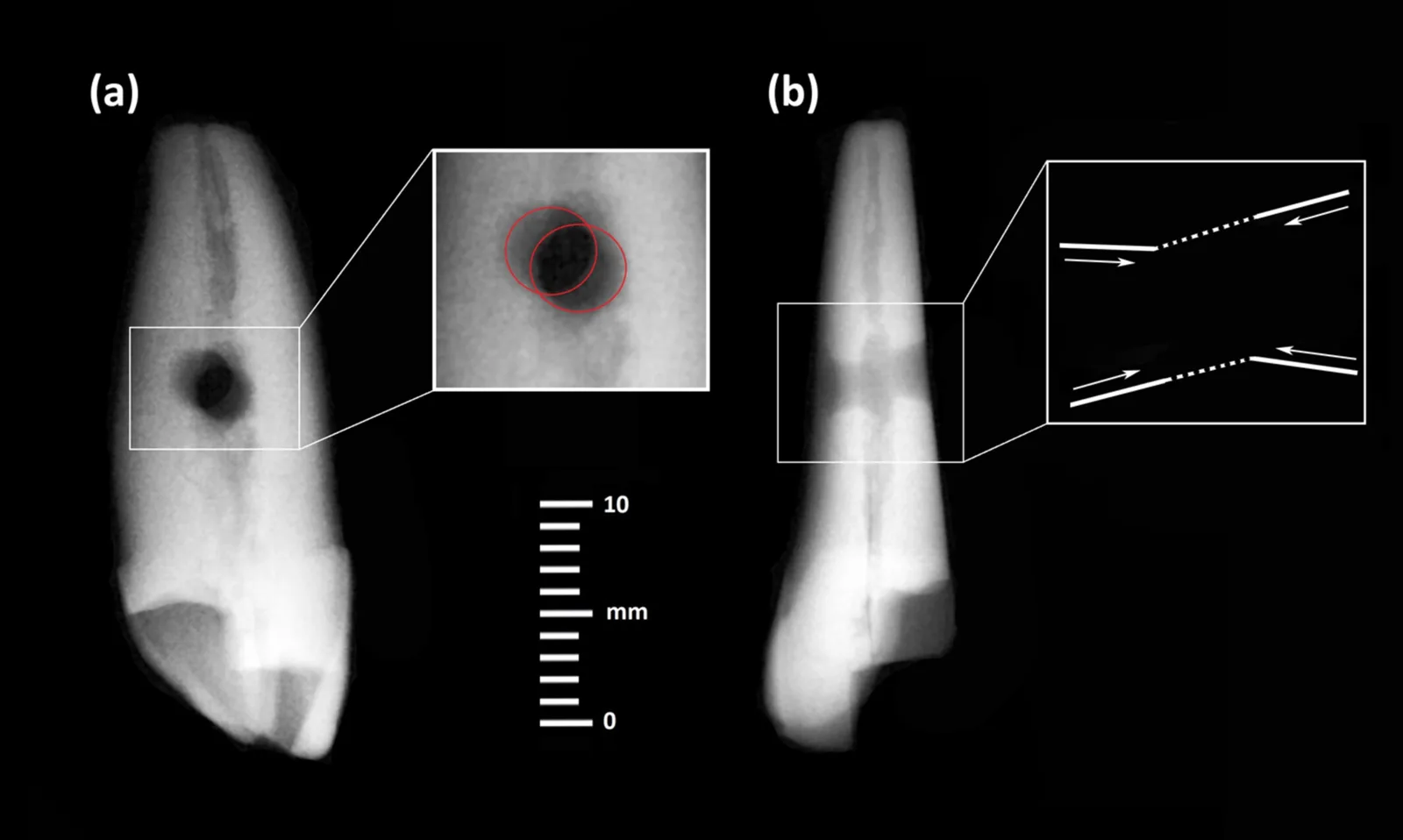 tooth 3