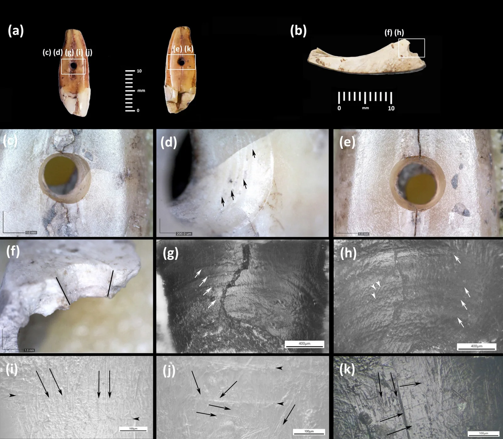 tooth 4