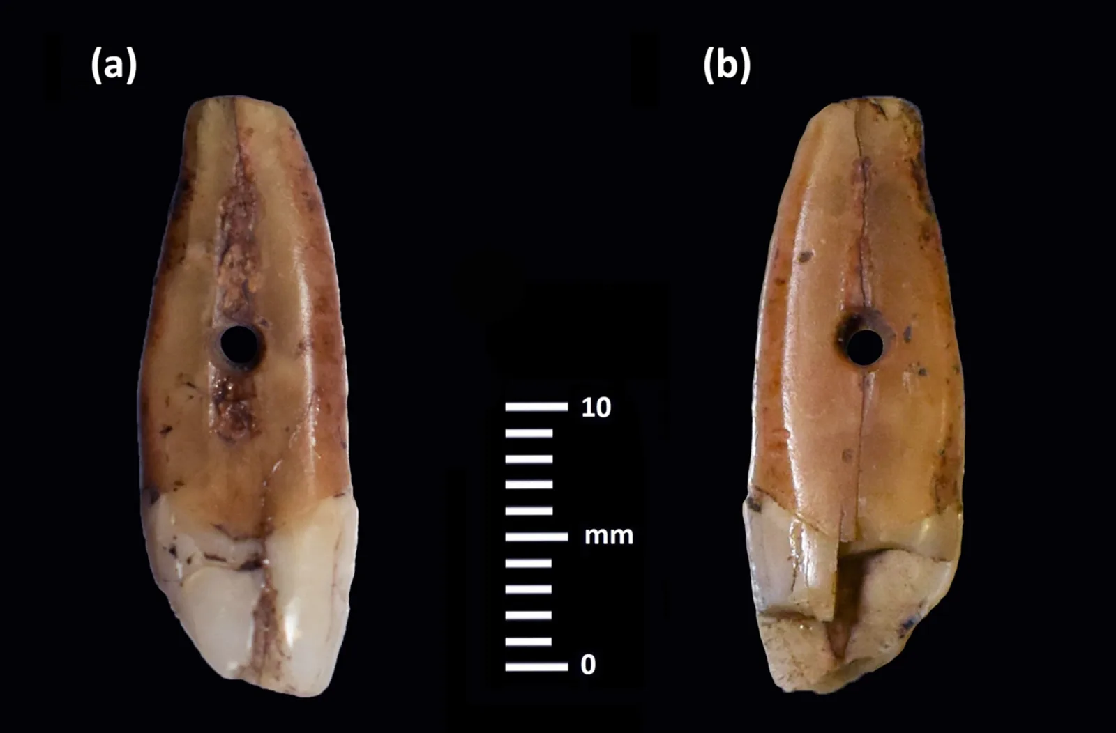 Tooth 1