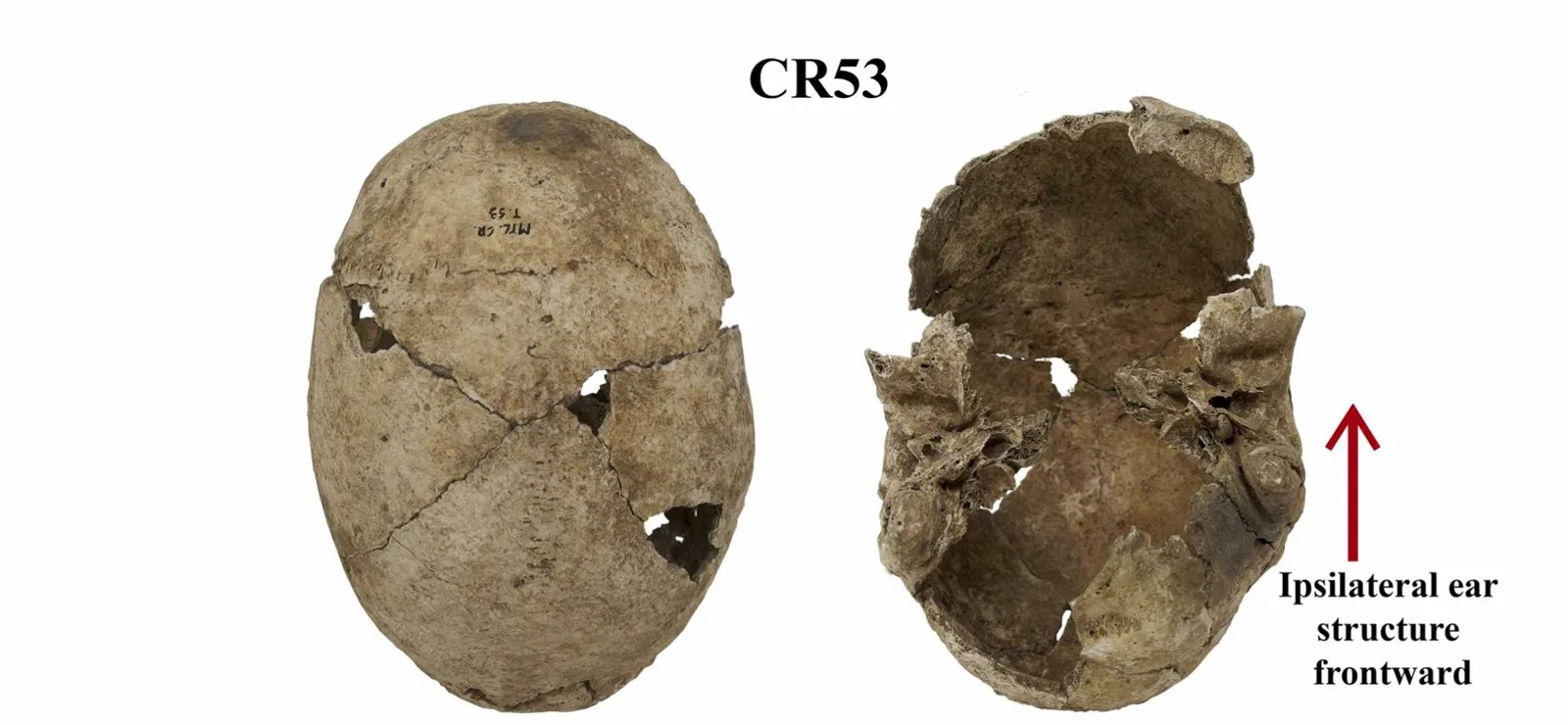 Iron age scull with flat head syndrom and some cracks