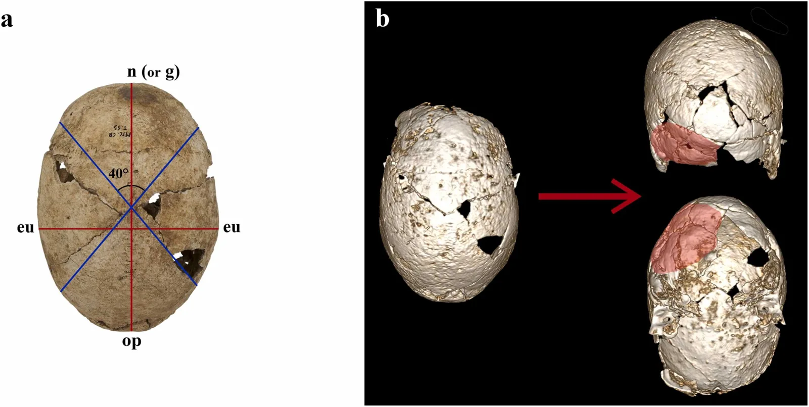 Measurements and CT scans checking how lopsided an Iron Age skull is