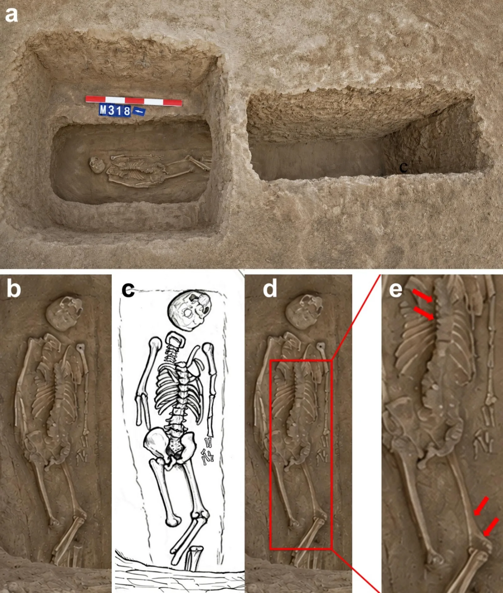 Photo of a rectangular grave with a skeleton lying inside, alongside close-up images and a diagram of the skeleton showing the spine and pelvis positioned face down.